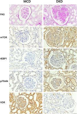 Unraveling DDIT4 in the VDR-mTOR pathway: a novel target for drug discovery in diabetic kidney disease